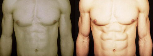 abs-before-after-retouch