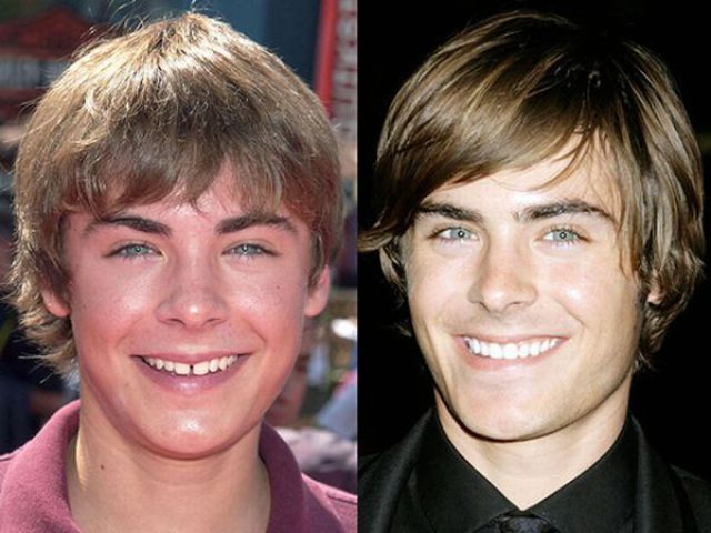 zac-efron-well_known_smiles_640_04